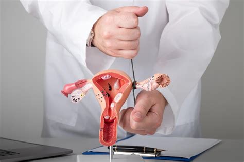 ligate | Ligate dalam Indonesia Terjemahan Inggris Glosbe Kamus