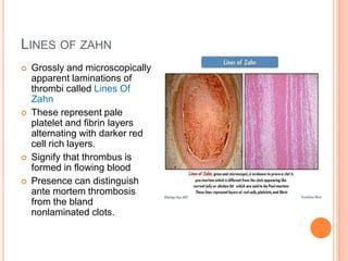 Lines Of Zahn