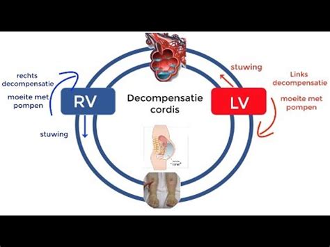 linkszijdig betekenis