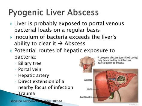 Liver Abscess Ppt