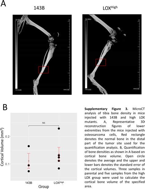 Lox Fak Osteosarcoma