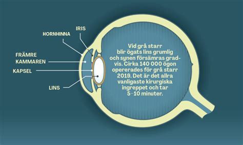 lukthallucinationer orsak