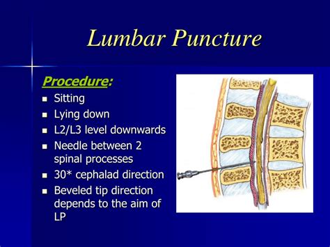 Lumbar Puncture Ppt