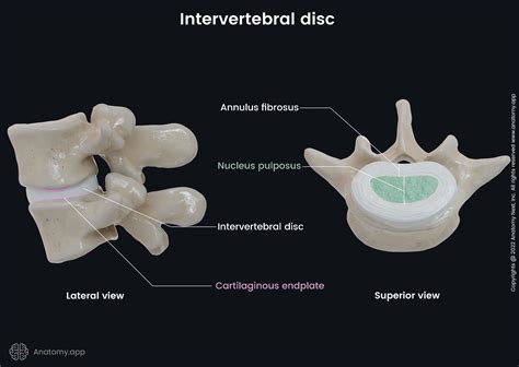 Lumbar Ve Diğer Intervertebral Disk Bozukluklari Radikülopati Ile