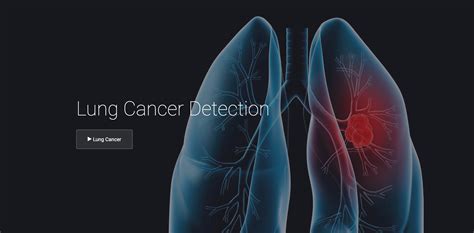Lung Cancer Detection Using Image Processing Techniques