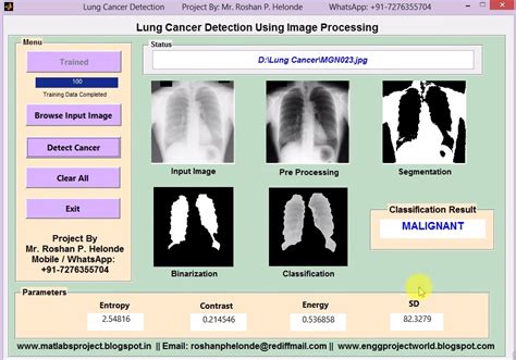 Read Online Lung Cancer Detection Using Image Processing Techniques 