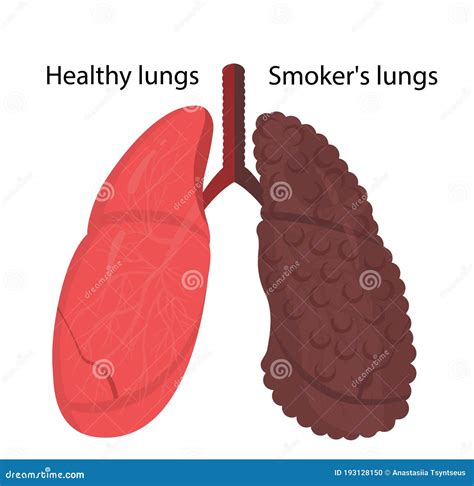 lungs - netvasco