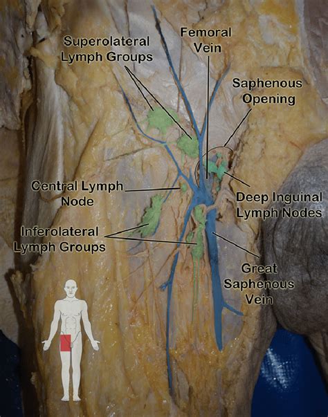 Lymph Nodes In Groin Male