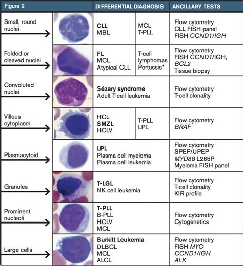 Read Online Lymphocyte Level Manual Guide 