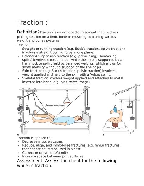 lyrical abs traction definition in c++