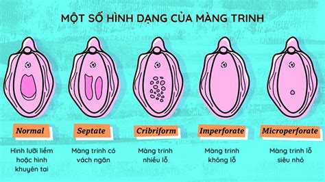 mất trinh | Mng trinh l g V tr nm