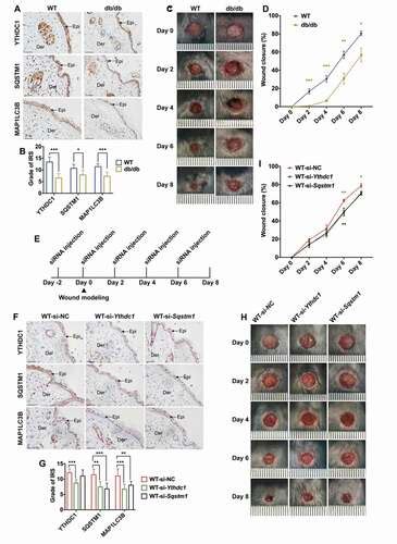 m6A reader YTHDC1 modulates autophagy by targeting SQSTM1 in diabetic skin