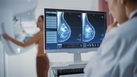 Mammographie En 3d   3d Mammography Tops Specialty Surgical Hospital - Mammographie En 3d