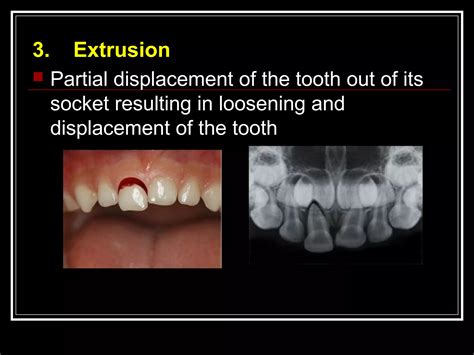 management of the failed dentition