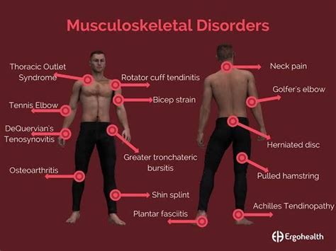 Read Online Management Of Common Musculoskeletal Disorders 