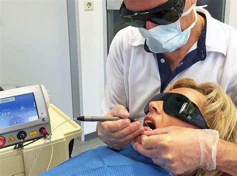 mandeln lasern erwachsene