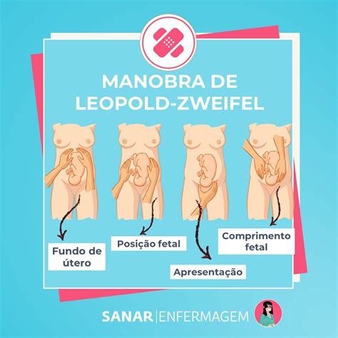 Manobras De Leopold