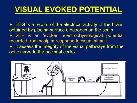 Manual For Visual Evoked Potential Nicolet