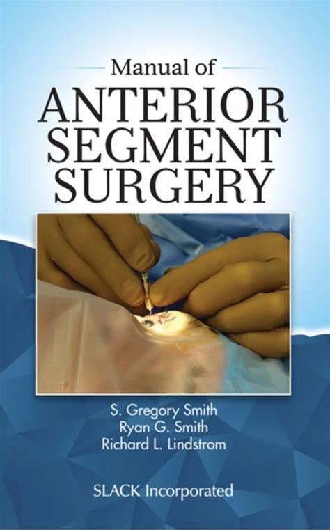 manual of anterior segment surgery