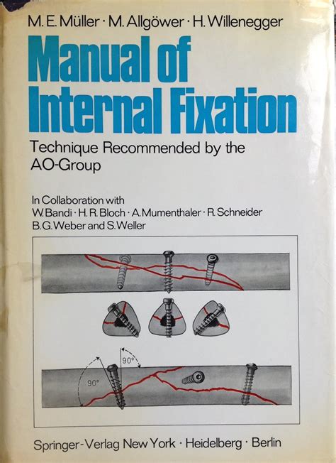 Manual Of Internal Fixation Technique Recommended By The Ao Group Swiss Association For The Study Of Internal Fixation Asif