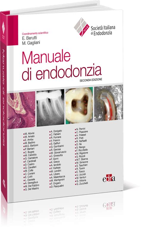 Read Manuale Illustrato Di Endodonzia Con Cd Rom 