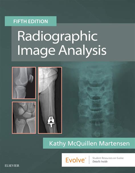 Martensen Radiographic Image Analysis