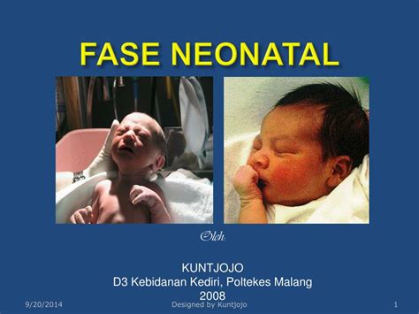 masa neonatal