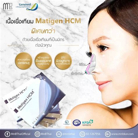 matigen