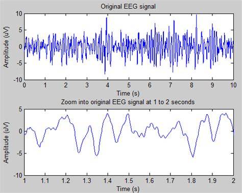 matlab code eeg signal
