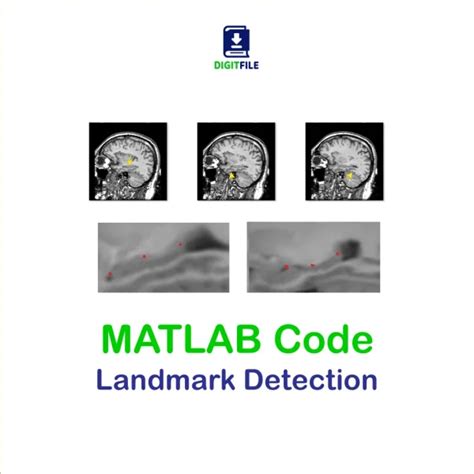 Matlab Code For Detection Of Moving Objects