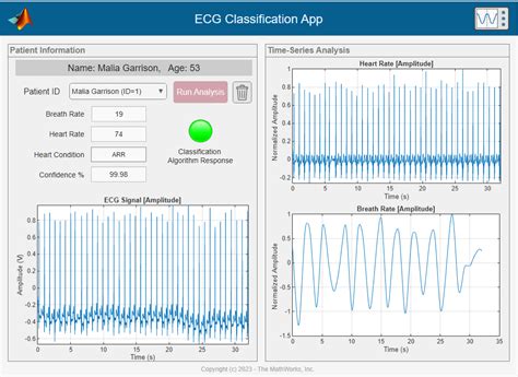 Matlab Code For Ecg Classification Using Knn