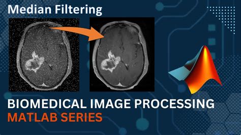 Matlab Code For Medical Image Fusion