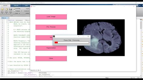 Matlab Code For Mri Brain Tumor
