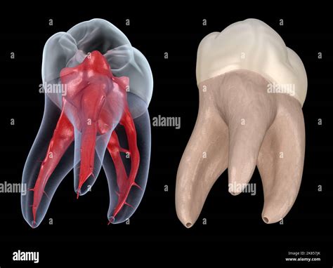 Maxillary First Molar
