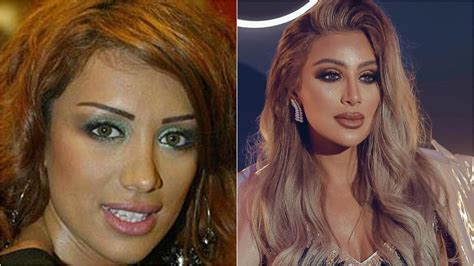 maya diab before and after