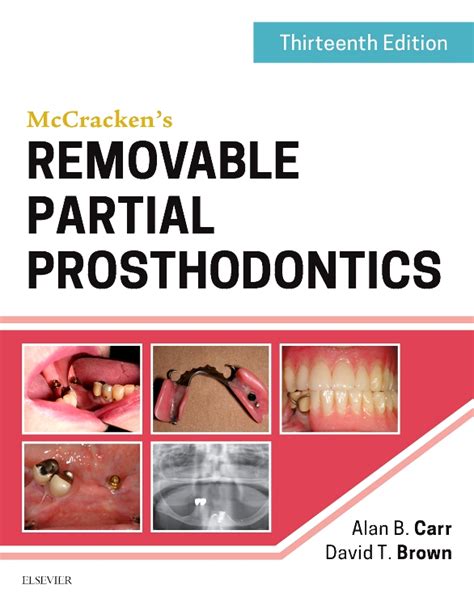 Mccracken Complete Prosthodontics