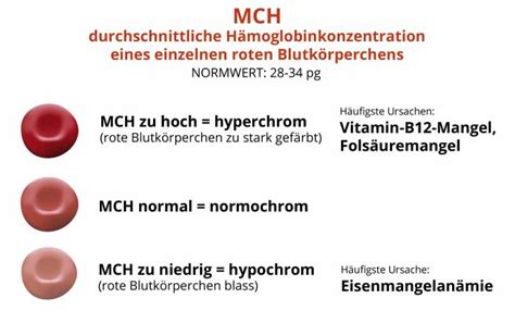 Mch Zu Niedrig