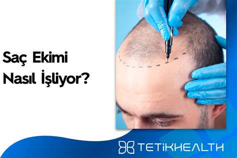 Möchte Fiil çekimi