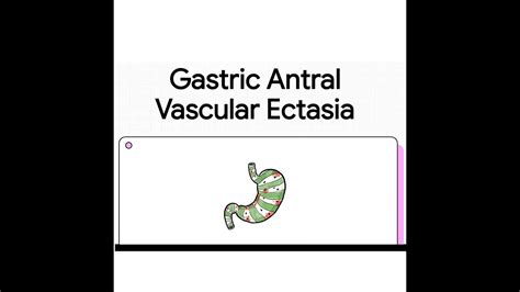 Medical Term For Ectasis