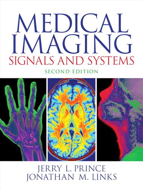 Full Download Medical Imaging Signals And Systems Pdf Book Pdf Book 