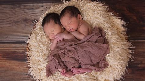 Mengenal Kondisi Bayi Kembar Siam, Penyebab, Serta Apakah 