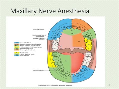 Mental Nerve Block
