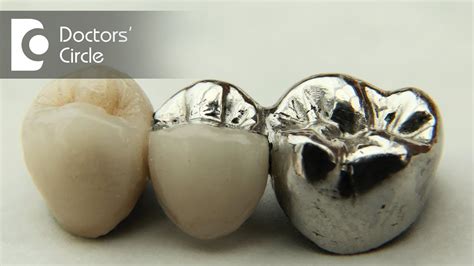 Metal Ceramic Crown