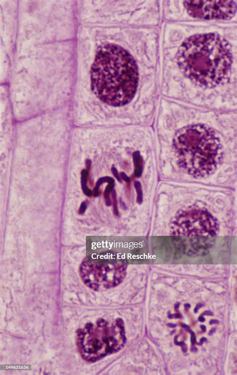 Metaphase Onion Root Tip