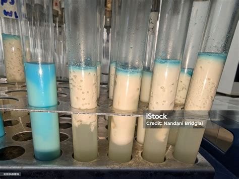 Methylene Blue Reduction Test