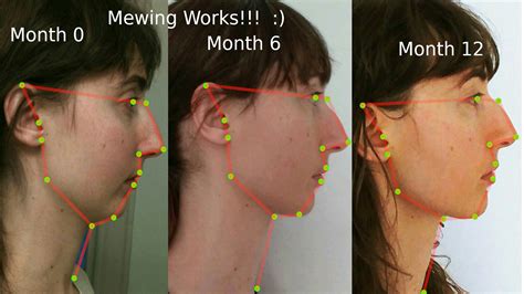 Mewing Meaning
