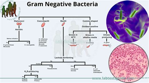 microbiology unknown gram negative bacilli flow chart