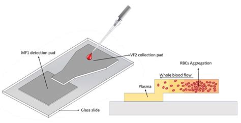 Microfluidic Plasma Separation And Paper Based Lateral Flow Strip