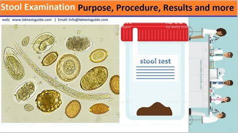Microscopic Examination Of Stool Atlas