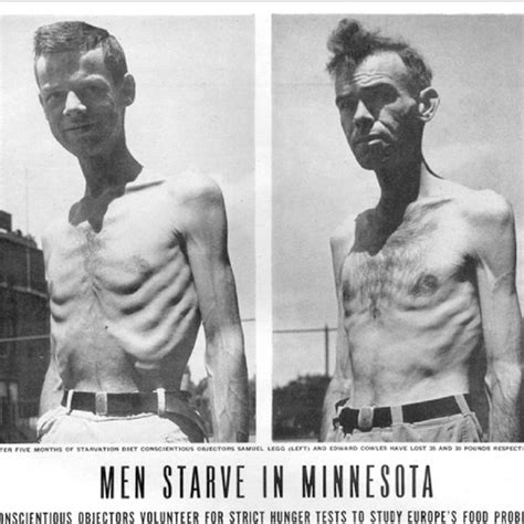 minnesota starvation study